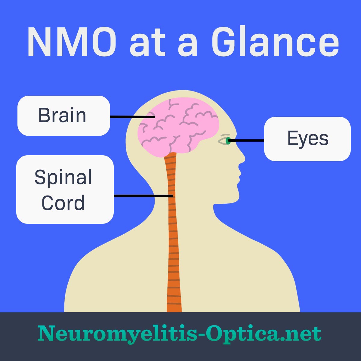 Human head and torso are shown with arrows pointing to the brain, spinal cord, and eyes.