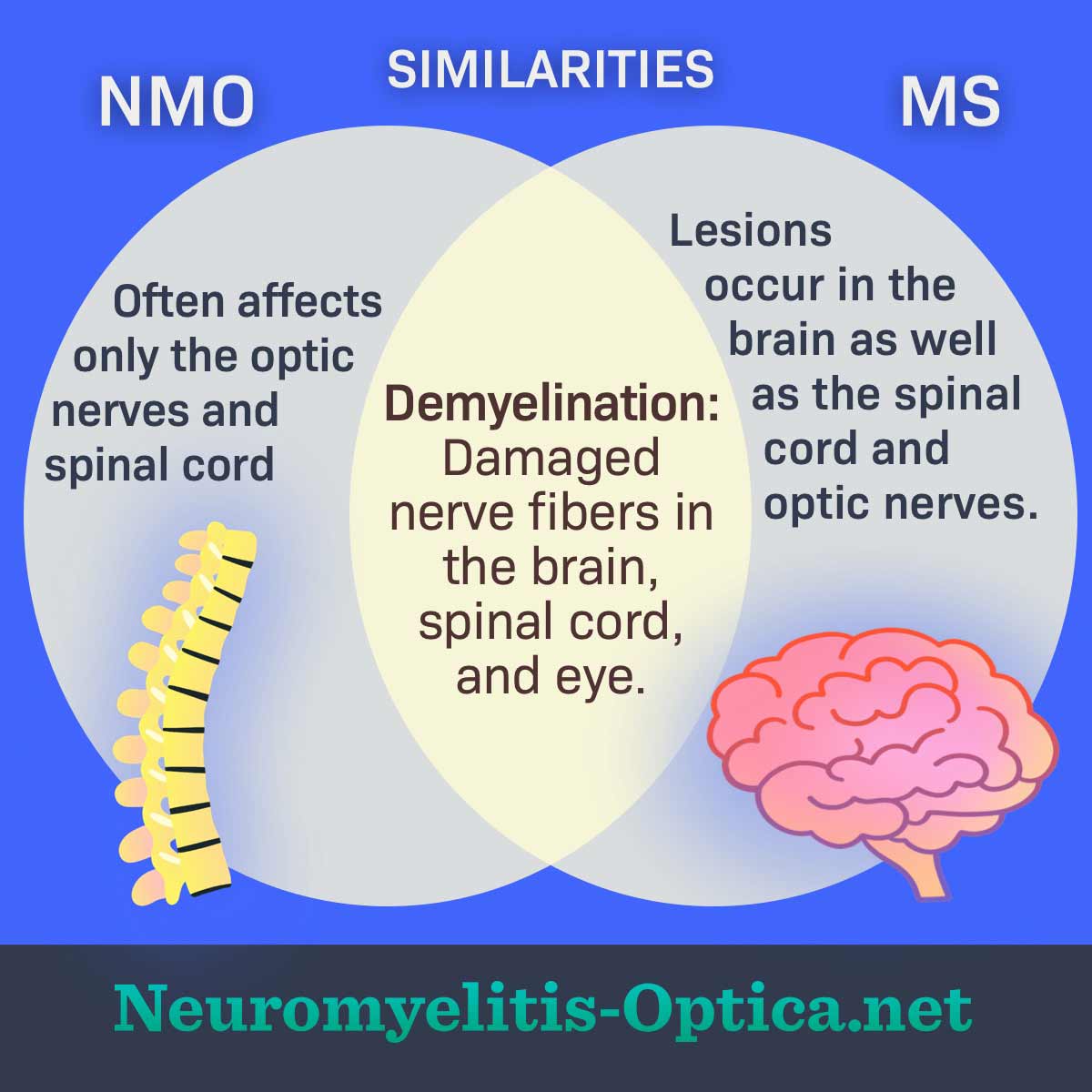 A chart breaking down the differences between NMO and MS side by side